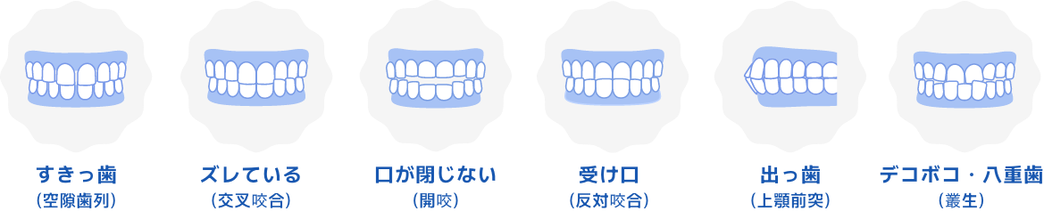 矯正歯科で治療可能な症例のイメージ